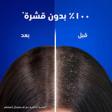 شامپو ضد شوره روزانه هد اند شولدرز head & shoulders مدل Daily Clean (400 میل )