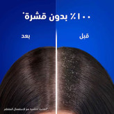 شامپو ضد شوره نعناع یخی هد اند شولدرز head & shoulders (400 میل )