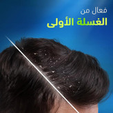 شامپو ضد شوره لیمو هد اند شولدرز head & shoulders مدل Deep Clean Severe Oily Scalp